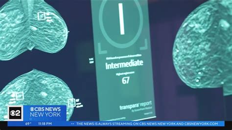 the villages breast cancer detection|Explainable artificial intelligence in breast cancer detection and .